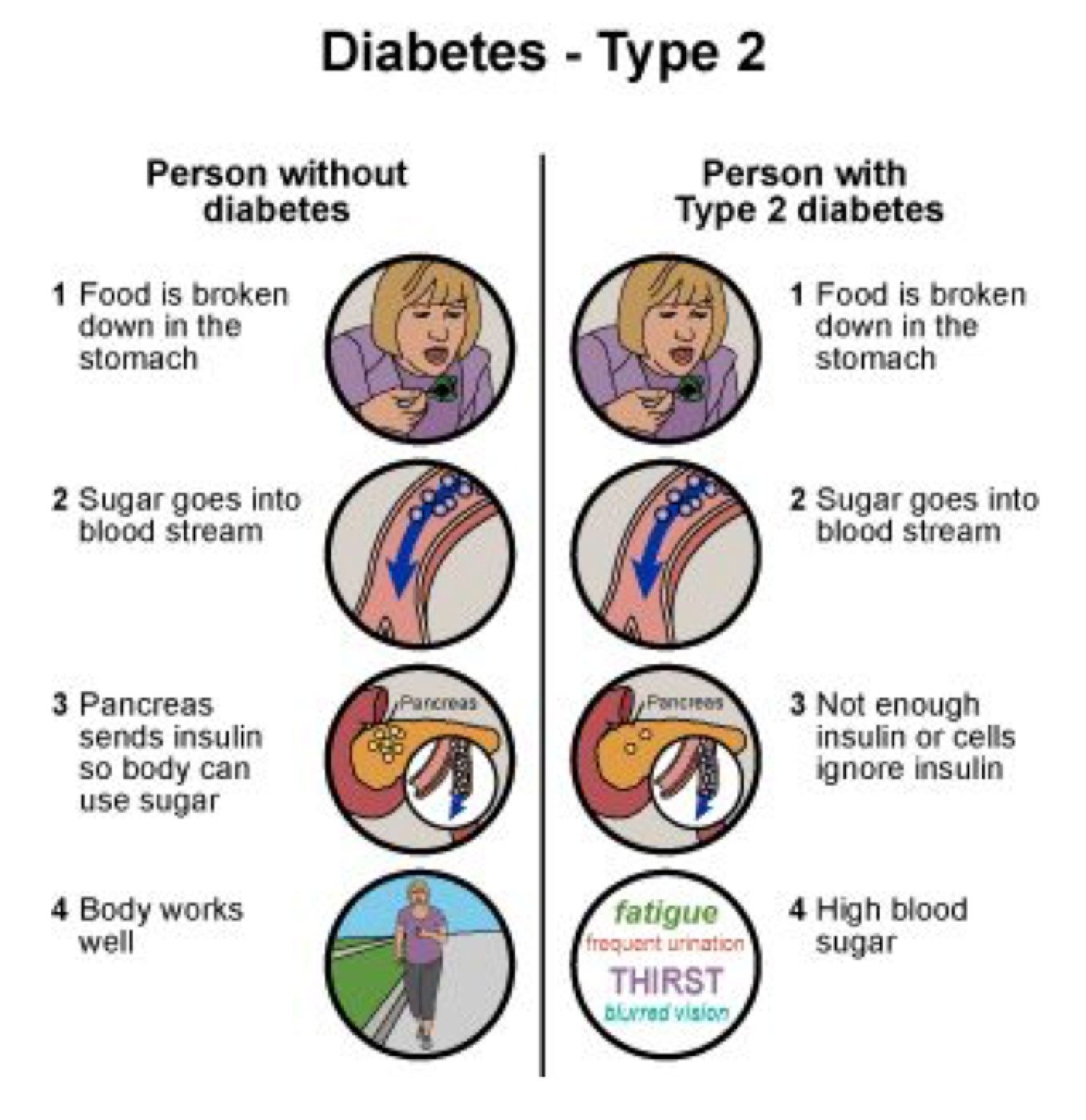 Diabetes Type 2 Hackensack Meridian Pascack Valley Medical Center