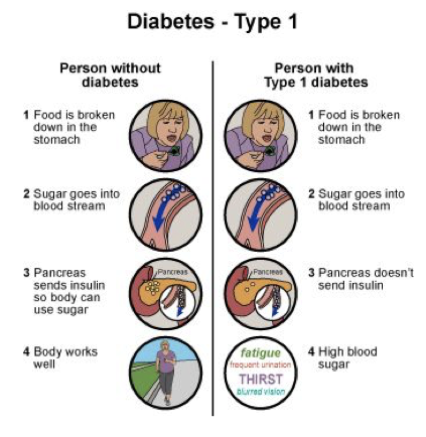 can type 1 diabetes cause heart attack